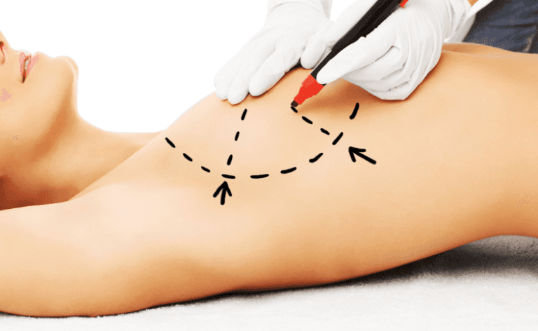 Breast augmentation, why?​