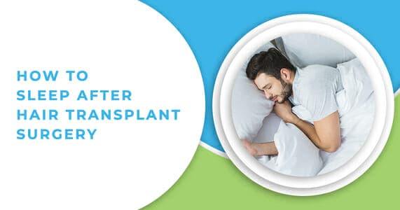 How to Sleep After Hair Transplant Surgery — Your Need-To-Know Guide