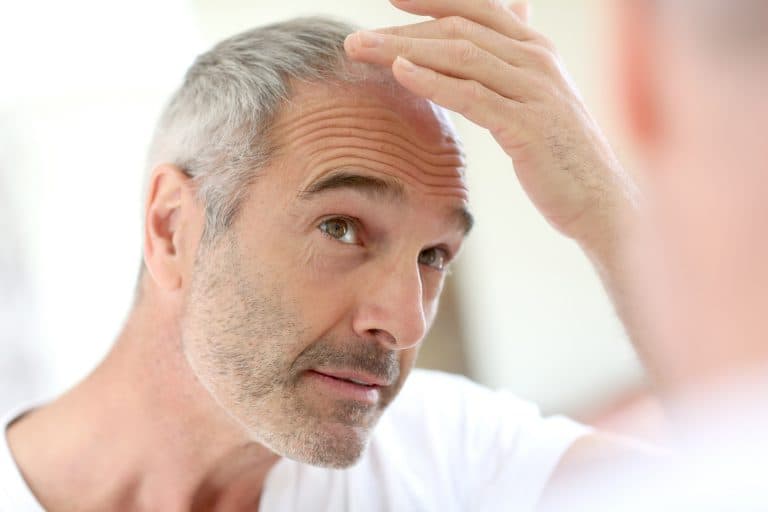 DHI Hair Transplant in Turkey 2022​