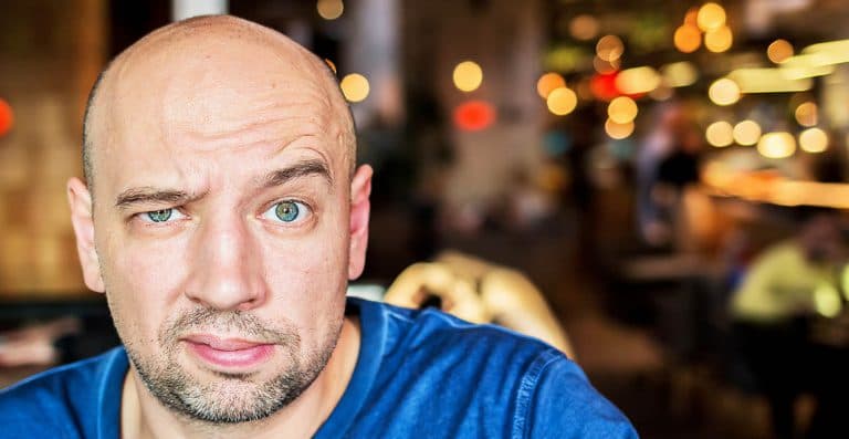 FUE hair transplantation and it’s advantages​