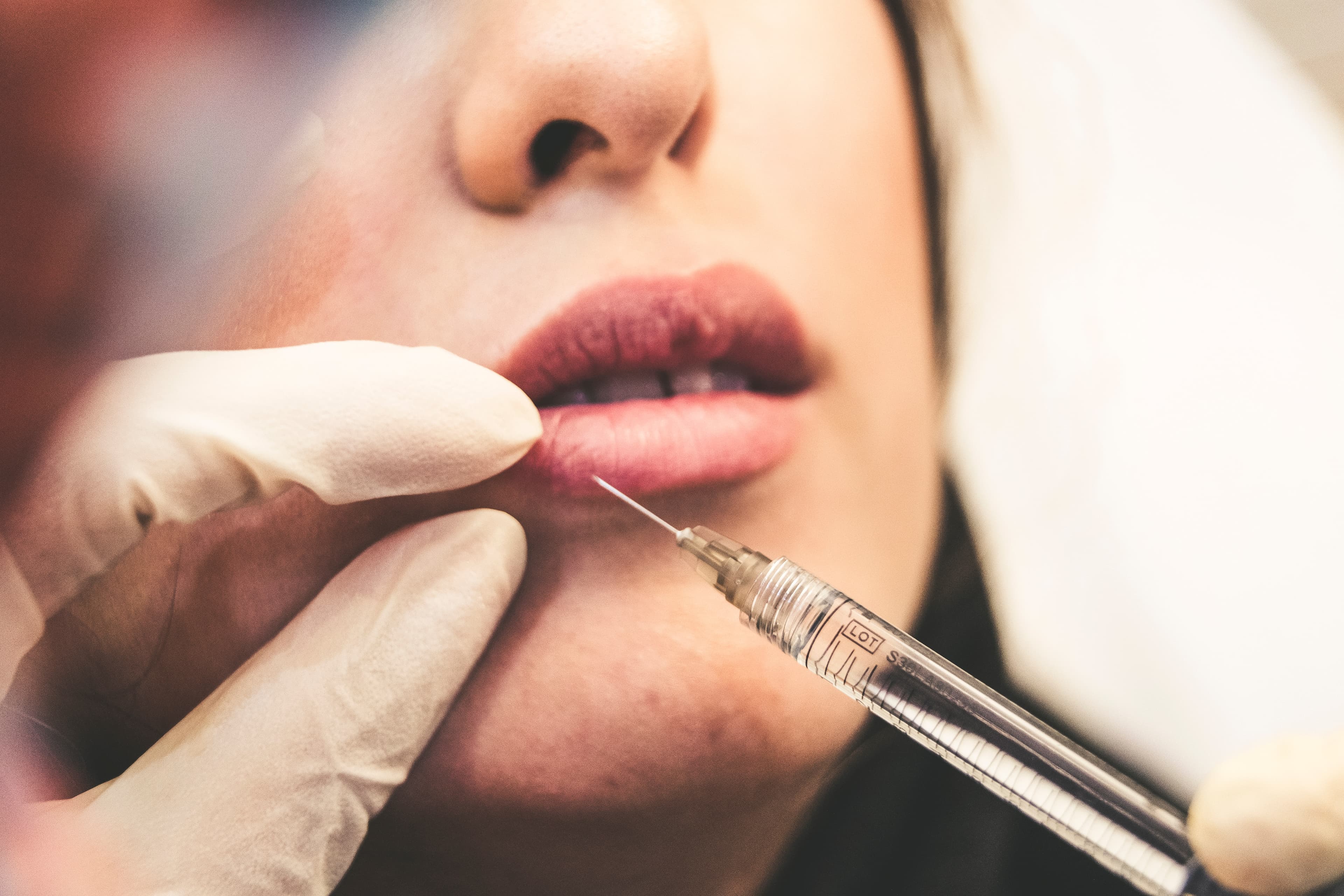 Facial surgery image