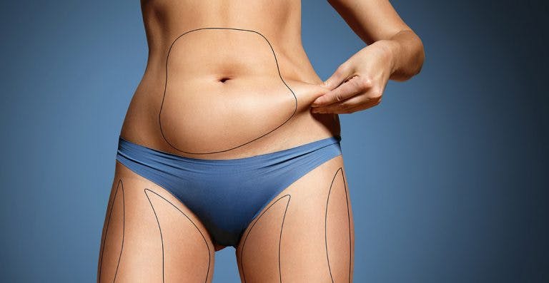 Most Popular Liposuction Types 2021​