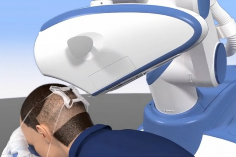 Hair transplant robots are becoming popular in 2022! Can we trust them?​